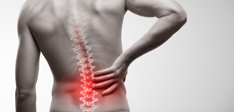 7 Equipamentos Baratos Que Aliviam Dor nas Costas em Minutos (Guia Definitivo 2025)